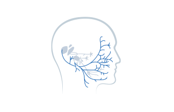 Stage 1: Stylomastoid Foramen Injury