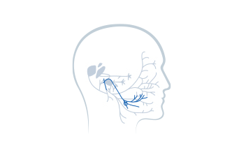 Stage 2: Chorda Tympani Nerve Injury