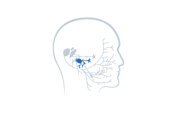 Stage 3: Nerve to Stapedius Muscle Injury