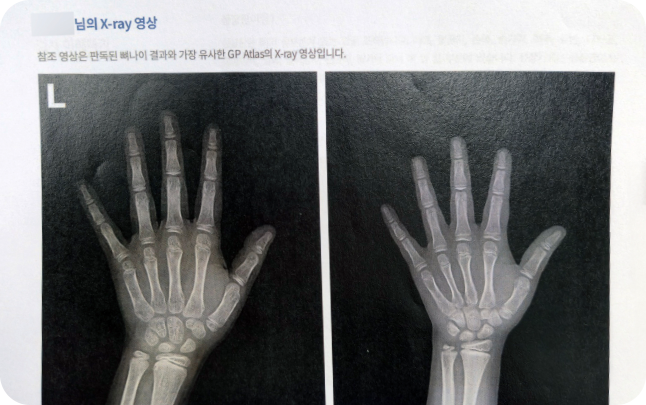 hand X-ray image