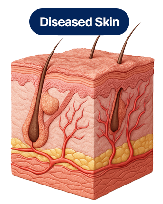 Diseased Skin